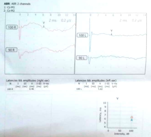 A newborn needs hearing aids