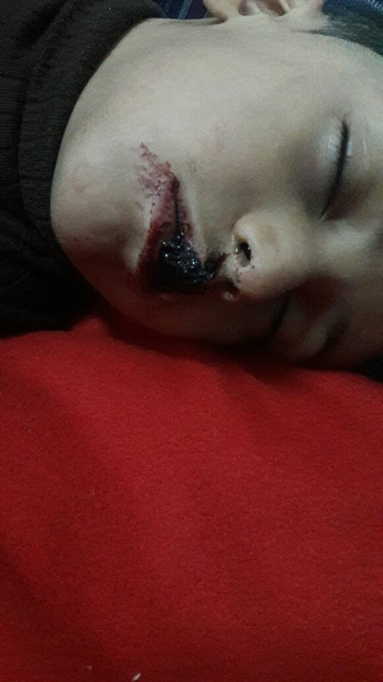 kid needs immediate treatment