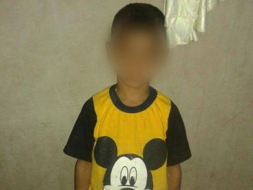 Treatment expenses for a child