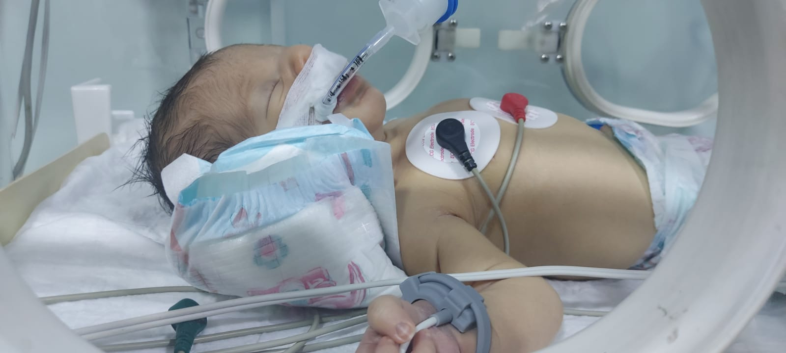 صغيرنا احمد بحاجة لعناية مركزة حتى يسترد صحته