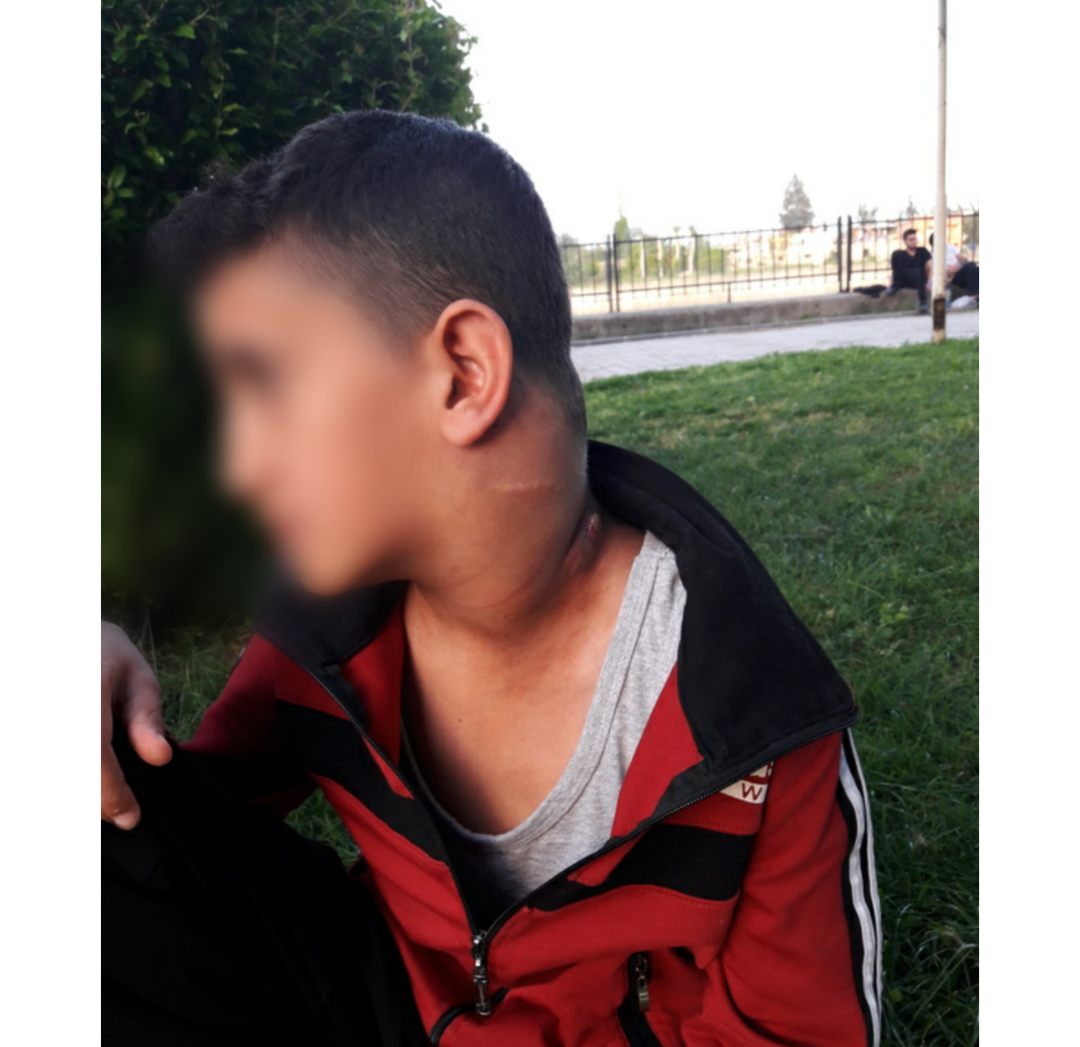 A little boy with Lymphoma!
