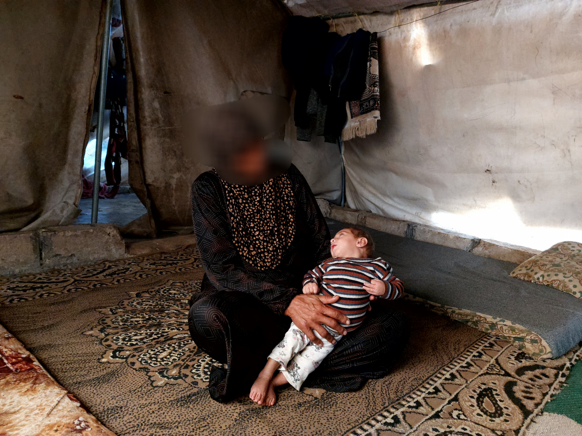 Abdul Hameed has congenital cardiac defect and cerebral atrophy