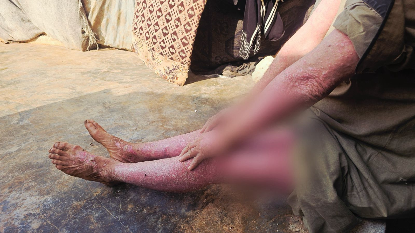 معاناة أحمد من الديون والأمراض