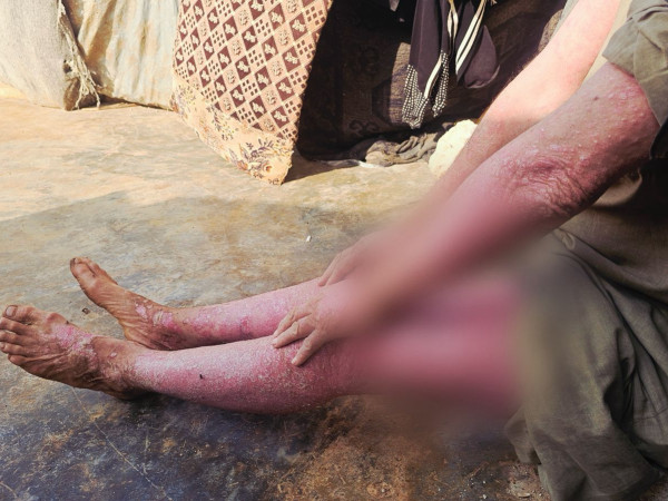 معاناة أحمد من الديون والأمراض