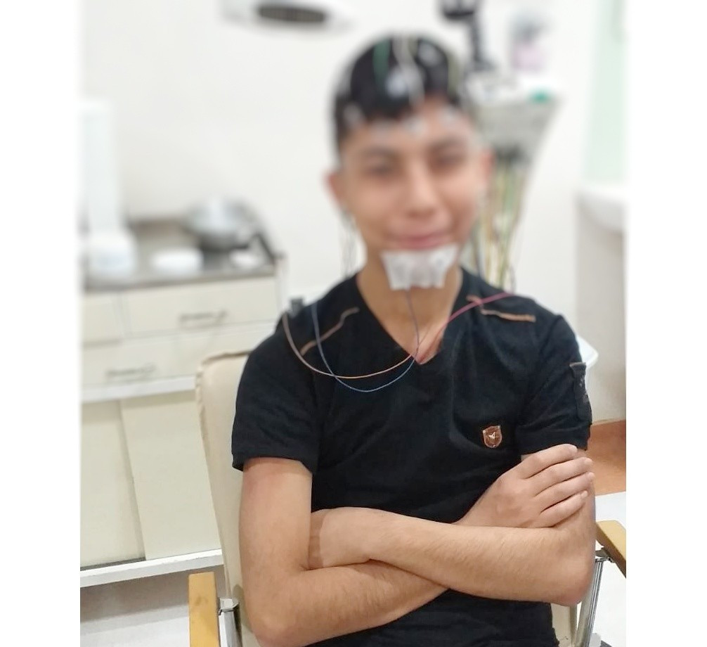 Yusif with epileptic seizures needs medications