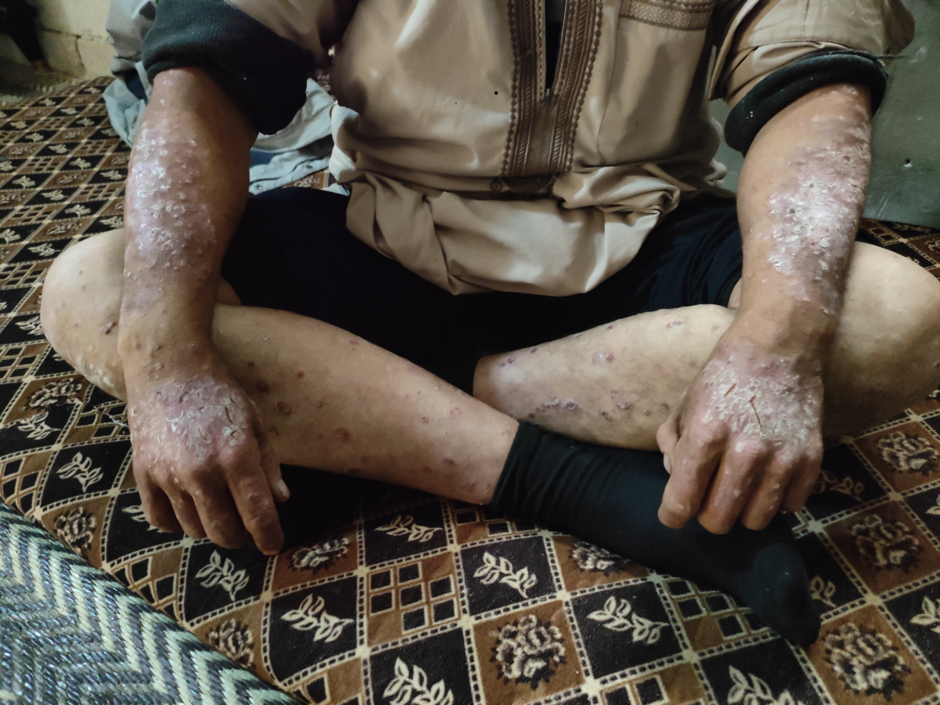 A Family Without a Provider, and a Sick Father