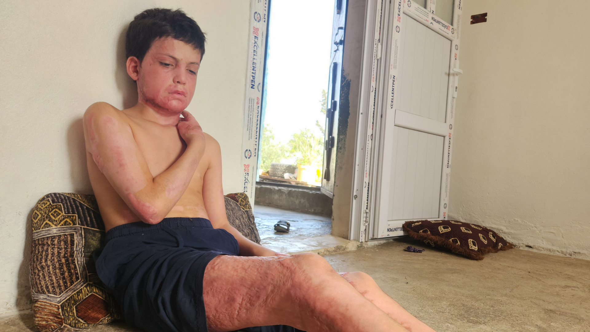 Ahmed needs your support to regain his childhood and live it in peace.