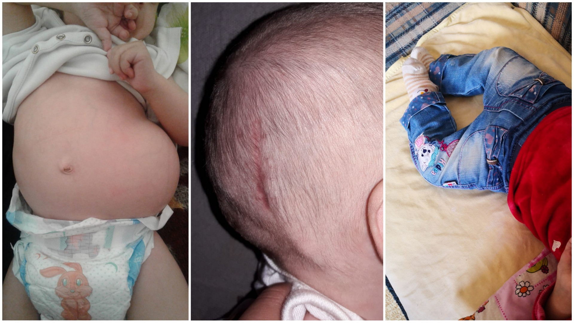 Shelling the hospital during the baby girl's birth
