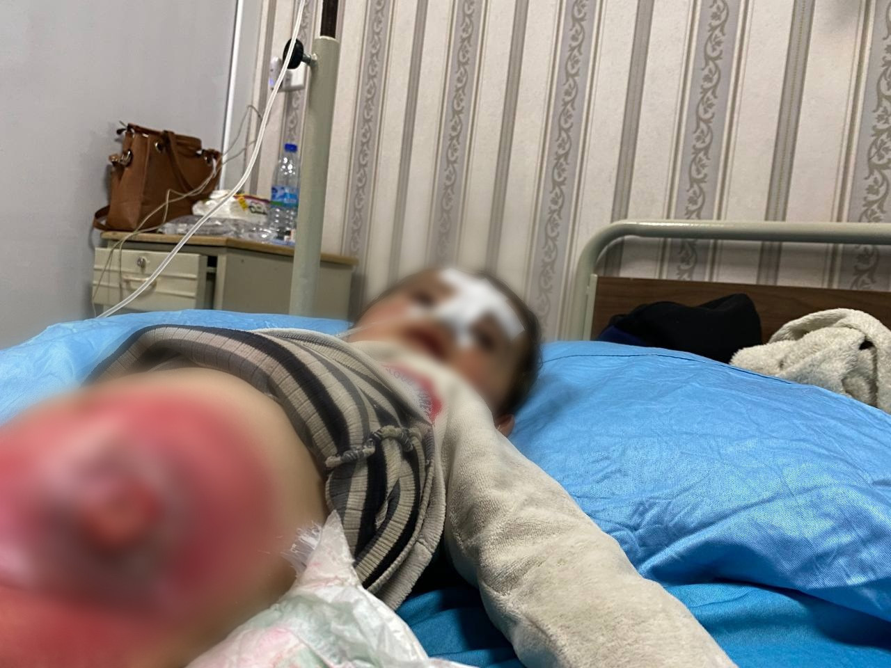 Abd Al-Rahman suffers from Hirschsprung's disease and surgery urgently.
