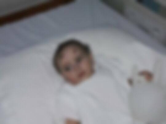 Child born with tumor mass