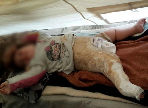 Medical Assistance for a Child