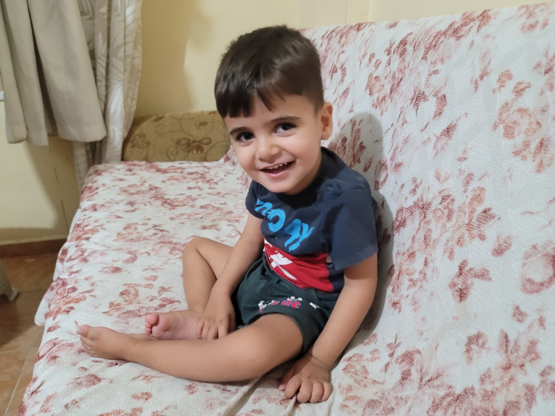 A Larger Brain Fissure at Birth: Leading to Paralysis in the Child