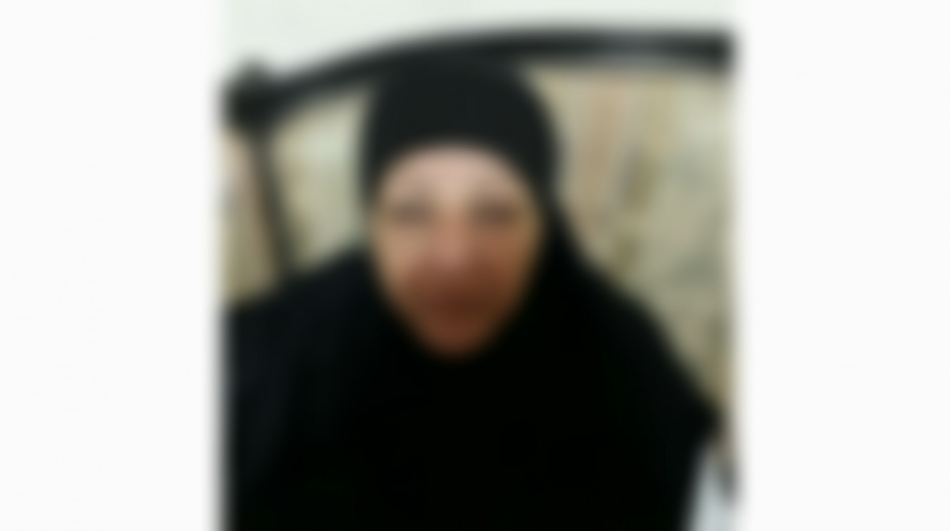 A woman suffers of cataract