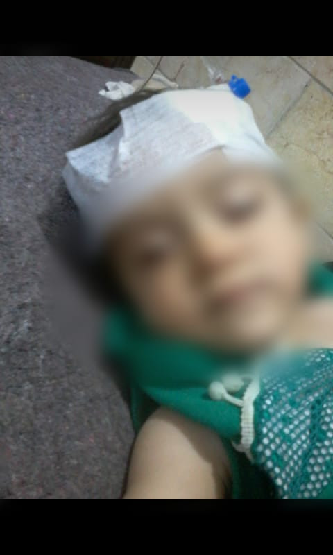 Amina needs your help securing cerebral shunt