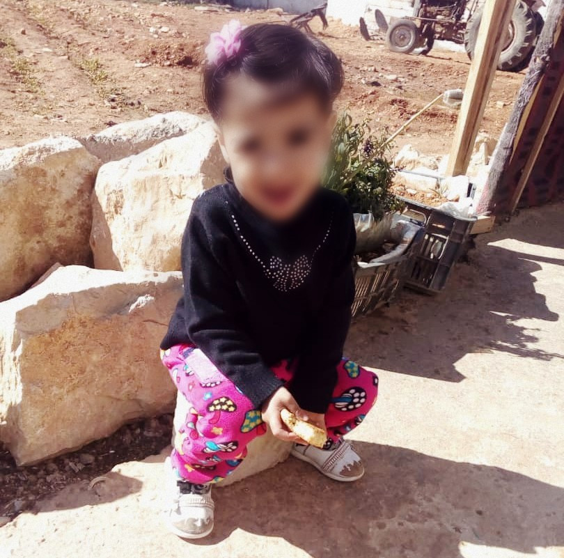 طفلة ولدت بتشوه خلقي
