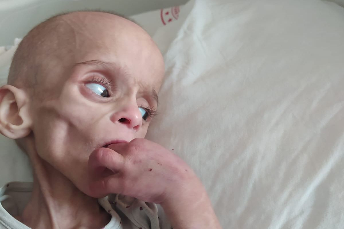 Let's save Mohammed and give him hope again.