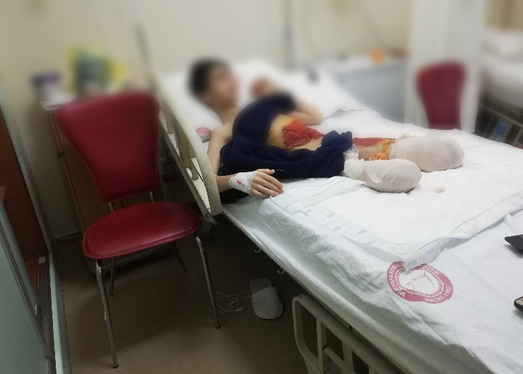A child that has lost his legs and the union with his family to get proper treatment
