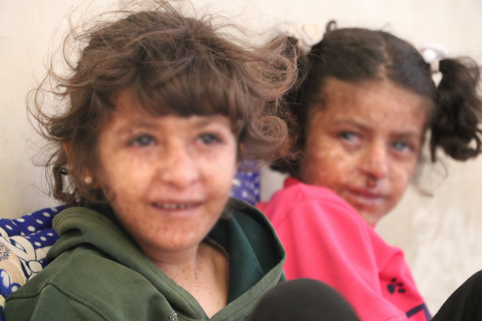 Shaima'a and Wa'ad are little girls suffer with sickness
