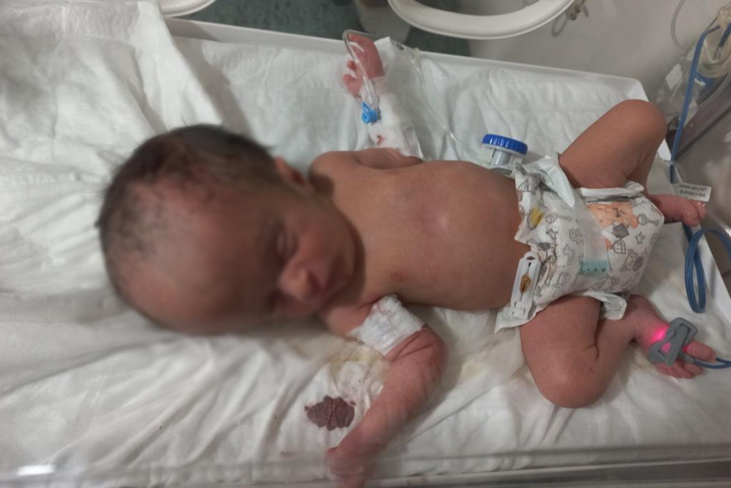 Youssef was born with hydrocephalus and needs a cerebral shunt