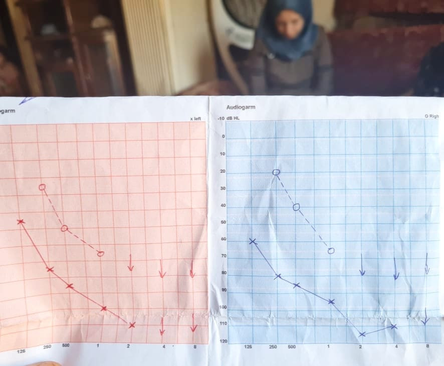 Shahad urgently needs hearing aids