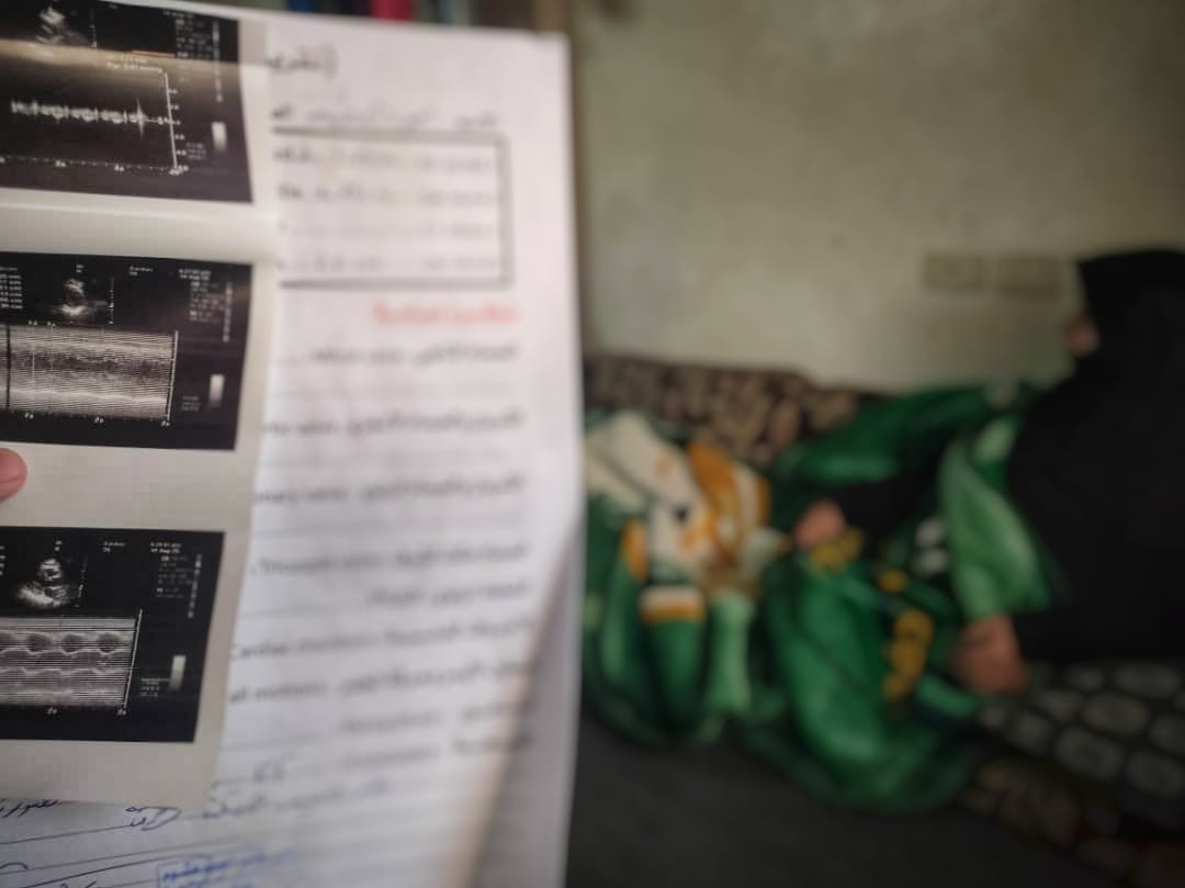 Majeeda suffers from arteriostenosis that requires urgent surgery