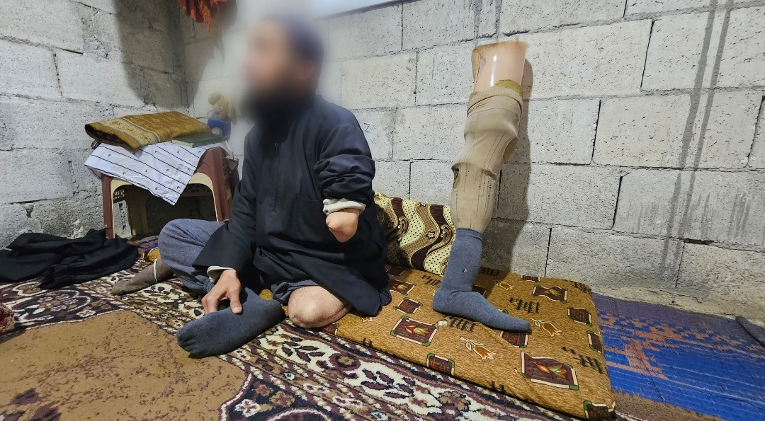 بُترت يده وساقه الأيسرين ، وبات بلا عمل .