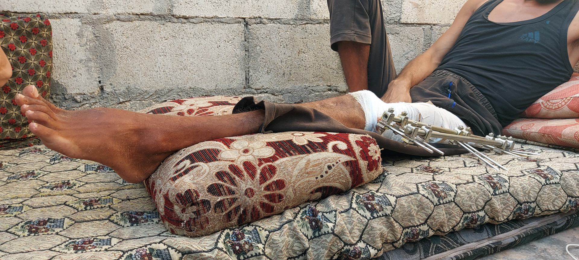 Amer has permanent disability and needs urgent help