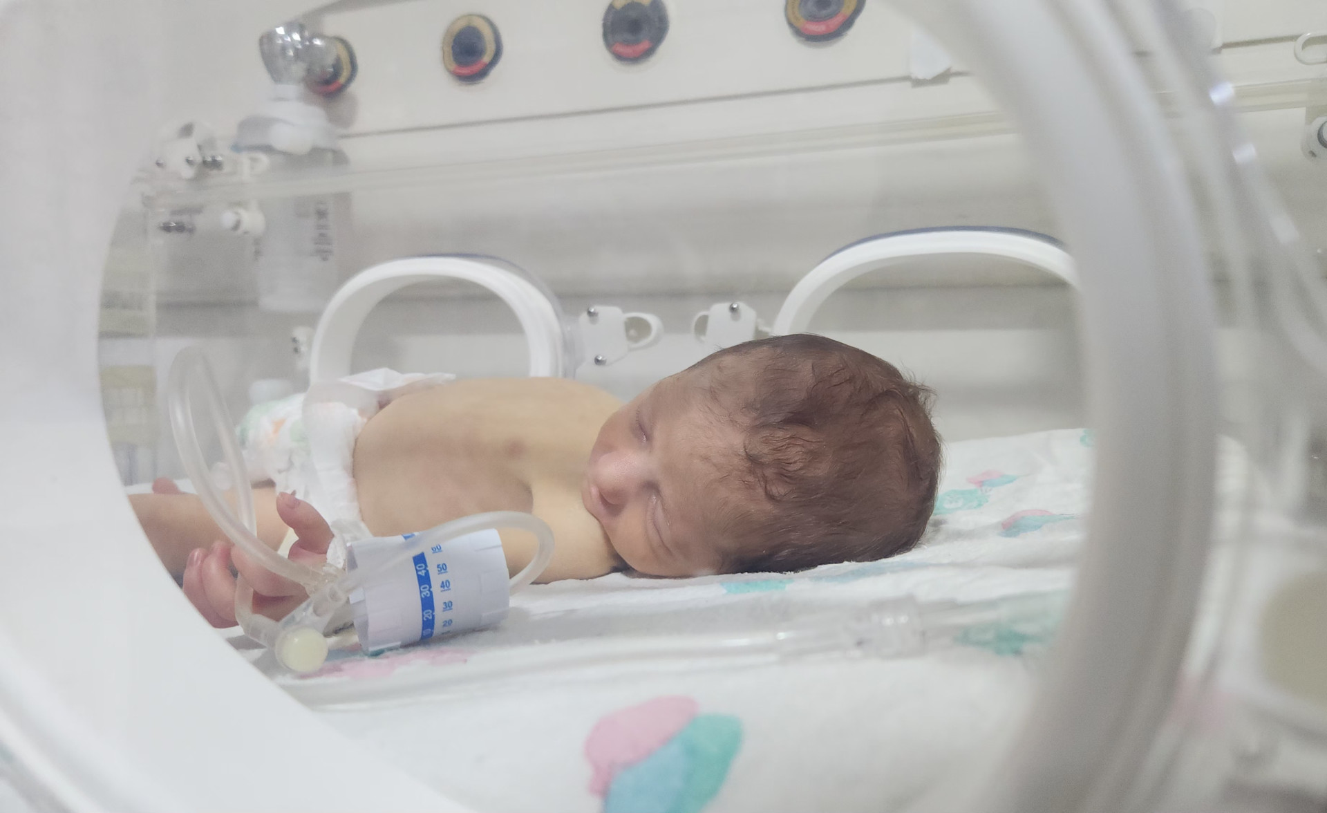 The newborn baby Shaimaa needs your help.