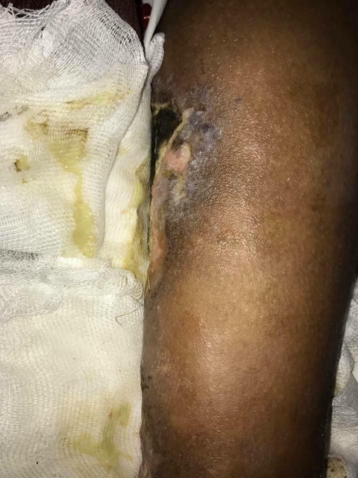 A patient needs treatment