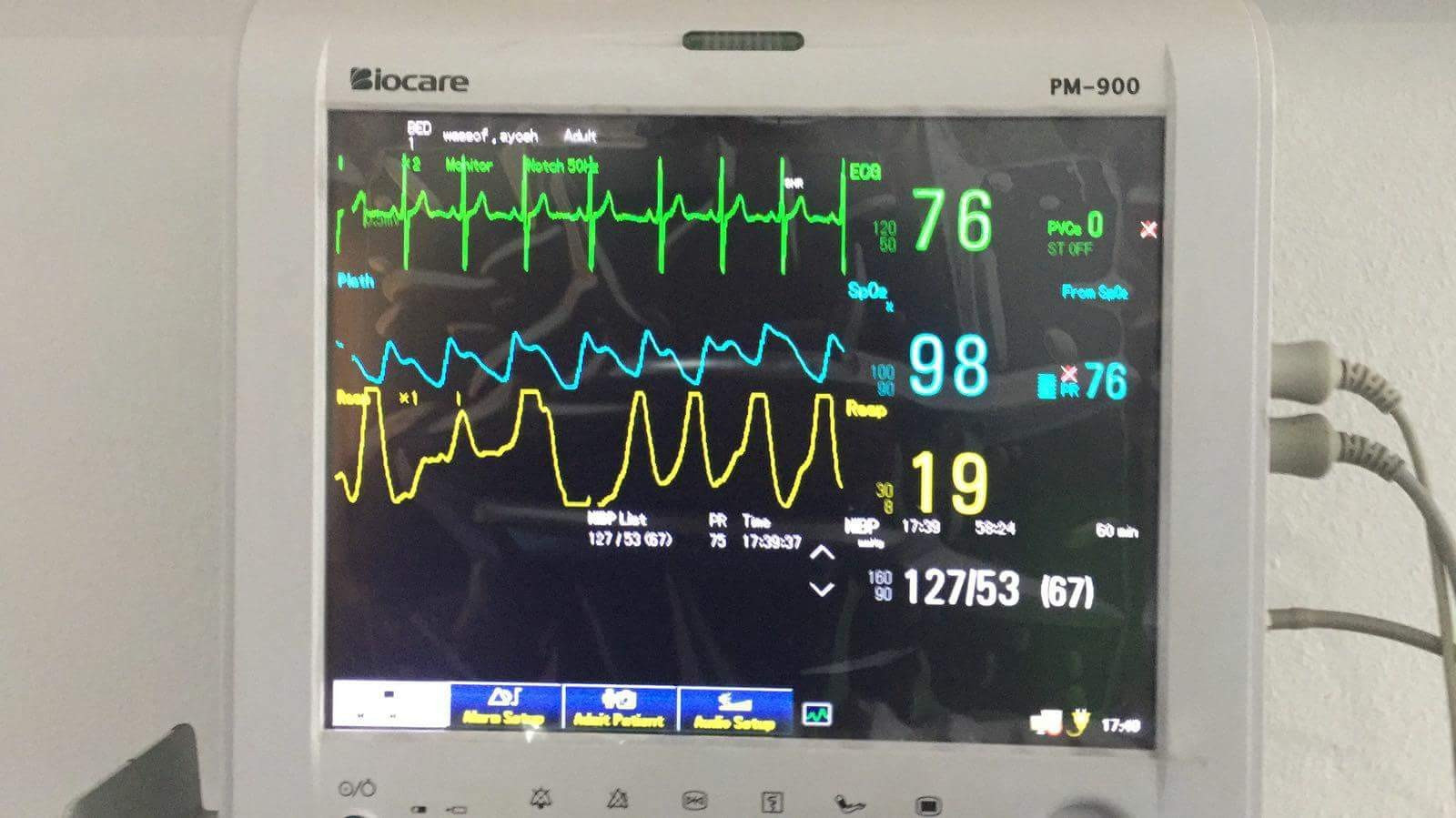 A Refugee in need for cardiac surgery within 2 days