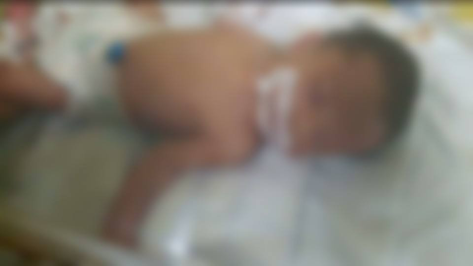Newborn needing an incubator