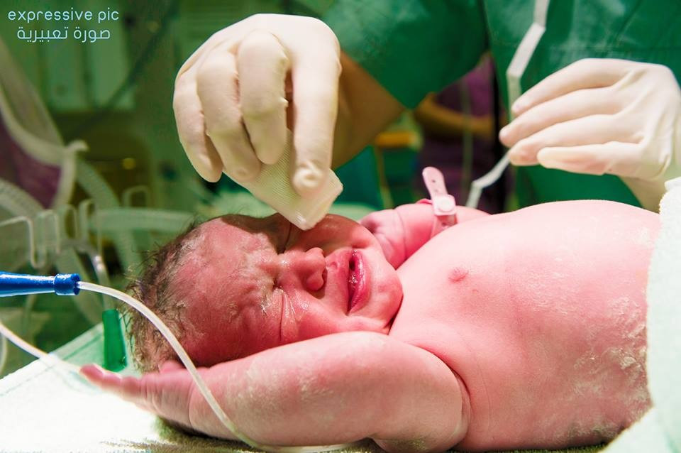 A pregnant woman needs birth operation costs