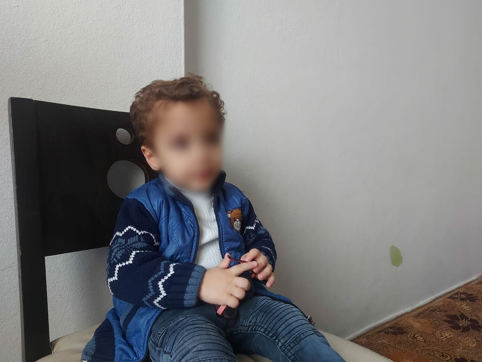 A baby suffering from a weak vision and needs your urgent help