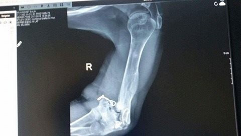 An Injured Man Needs a Surgery