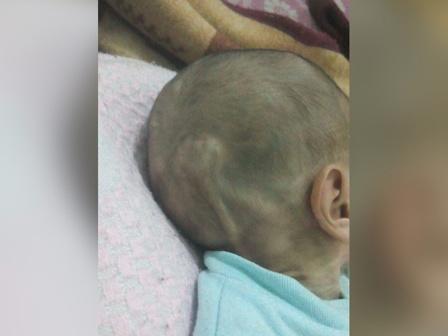 an infant with bad medical conditions