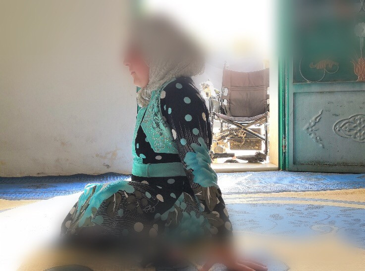 طفلة ولدت بأحد أنواع شلل النخاع الشوكي