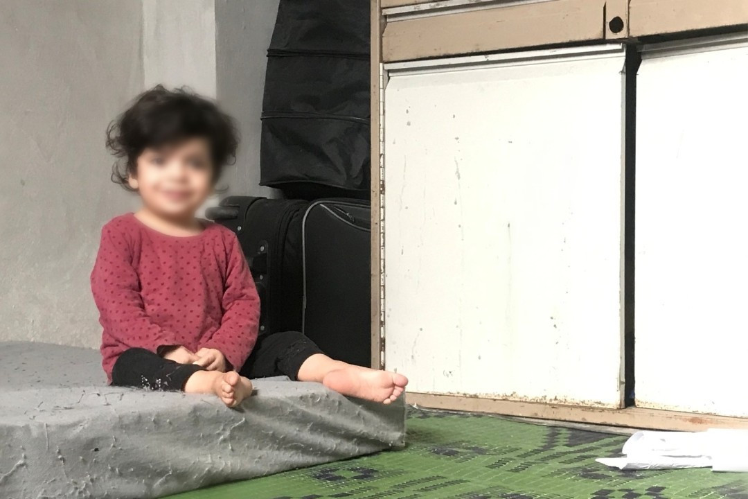 She is 2 years old with a cardiac congenital defect
