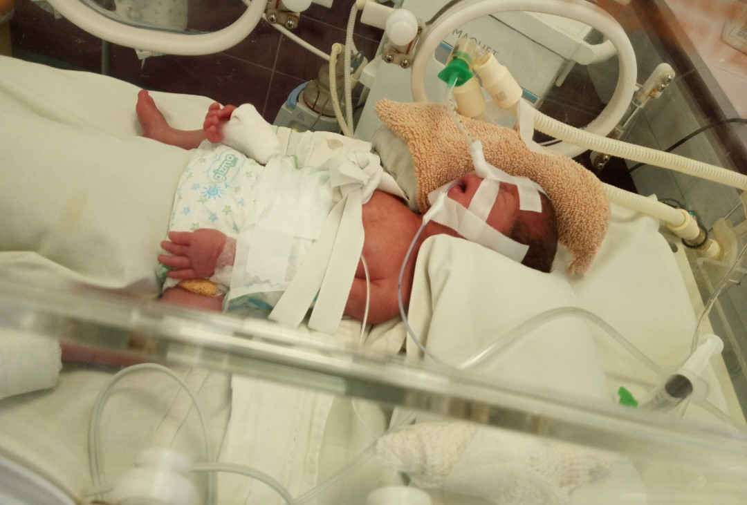 Urgent Support Needed for Premature Baby Ayat's Medical Procedure