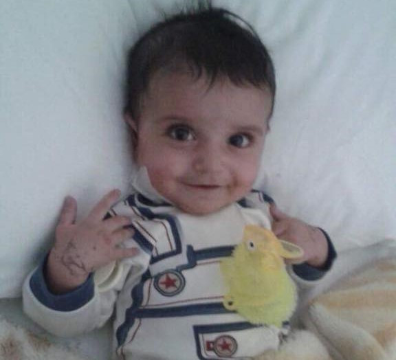 An infant child needs a heart surgery