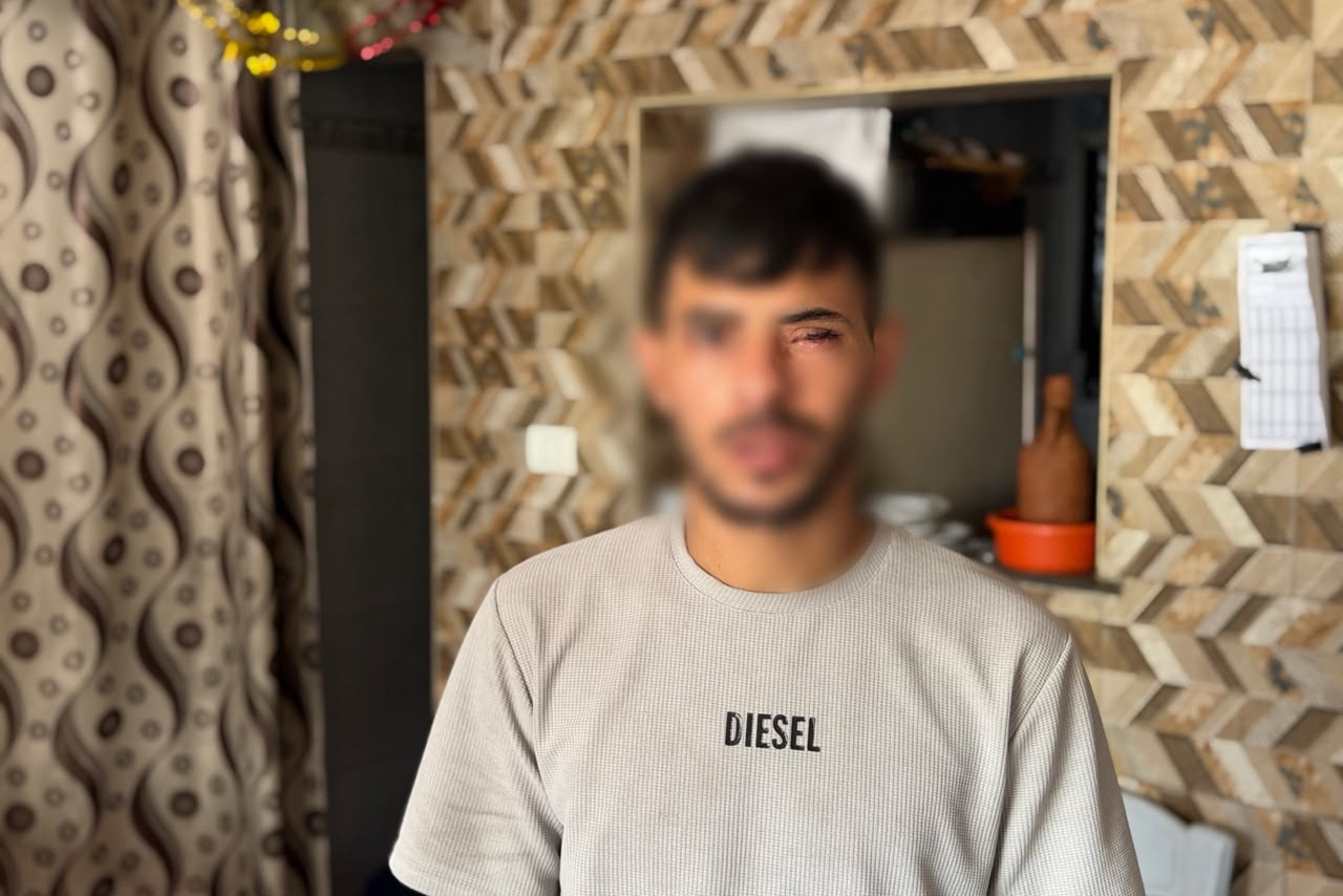 ياسين يخسر عينيه بسبب القصف