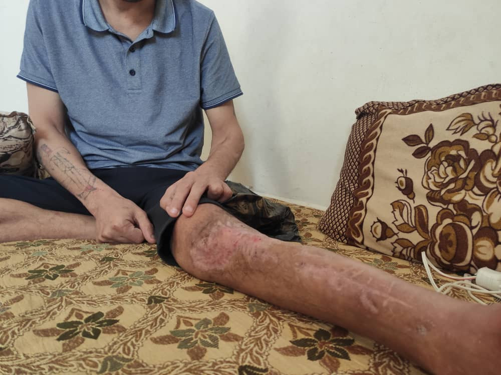 Isaam needs your help to afford his treatment