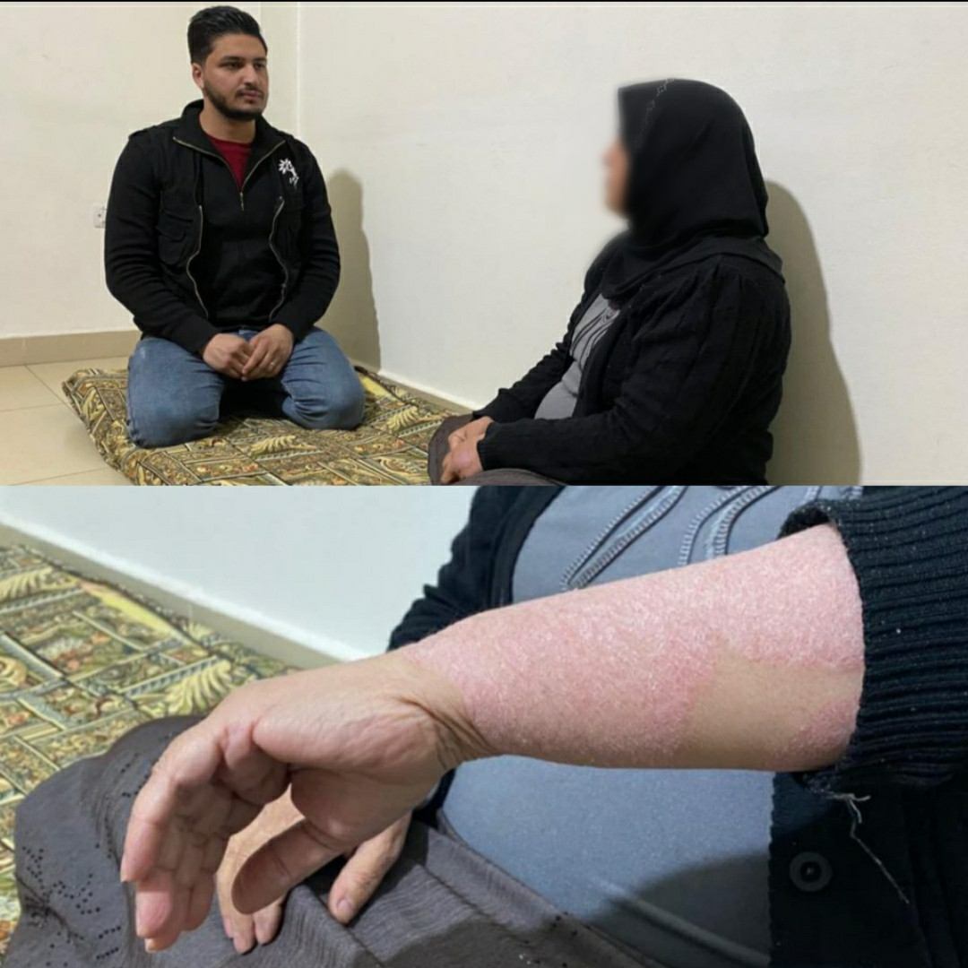 Maha is with psoriasis and needs treatment