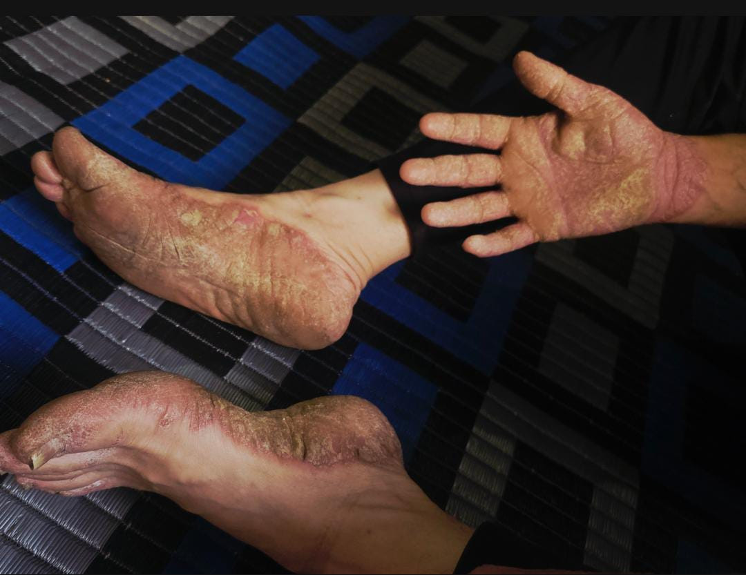 مرضٌ يشتد وحالٌ يضيق