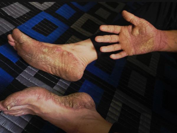 مرضٌ يشتد وحالٌ يضيق