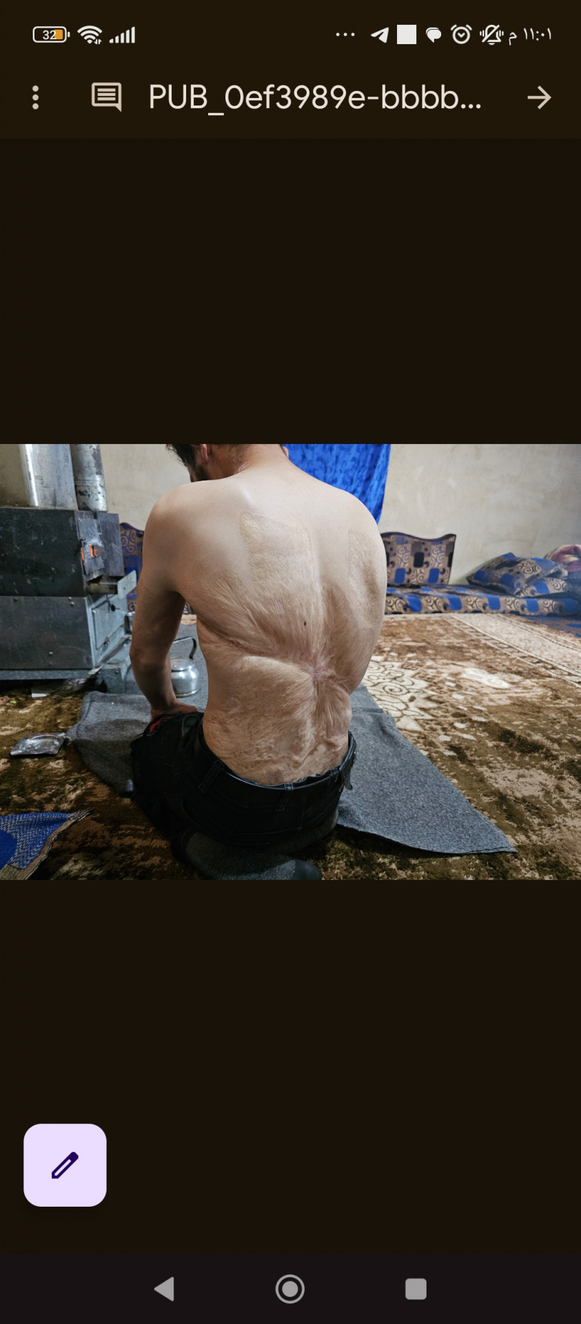 مأوى بلا أمان… وألمٌ لا يهدأ