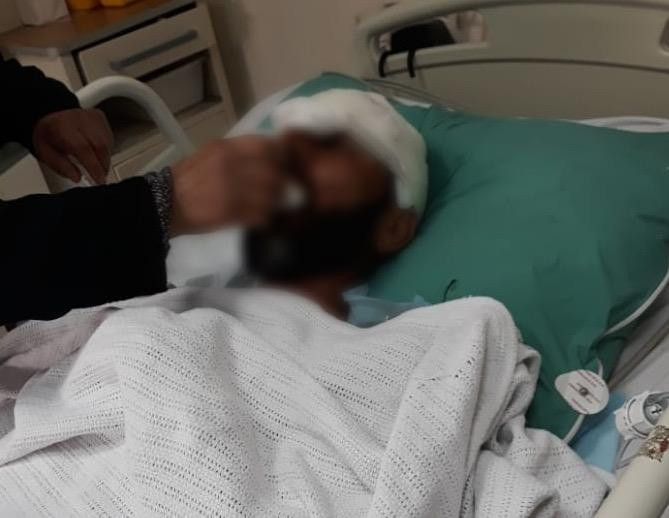 Obeida needs urgent help after an accident that left him with many fractured bones throughout his body!
