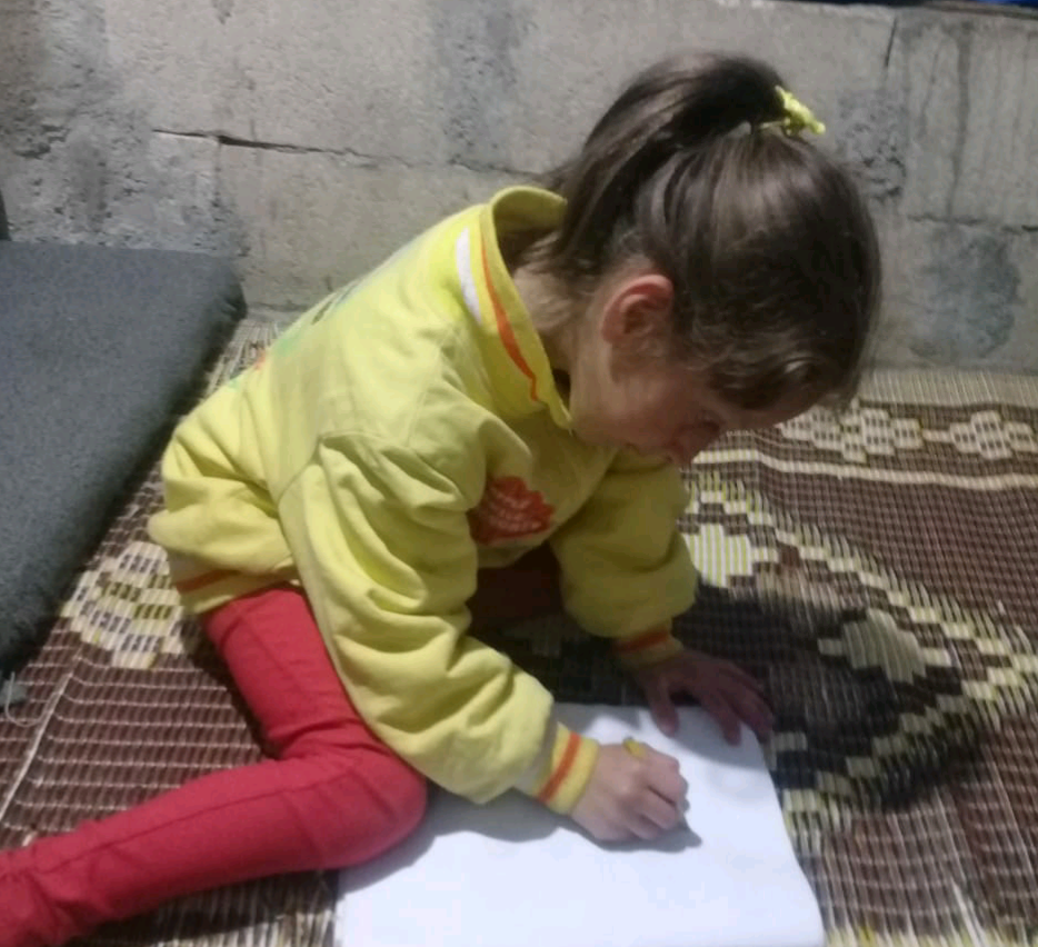 A little girl with Growth impairment!