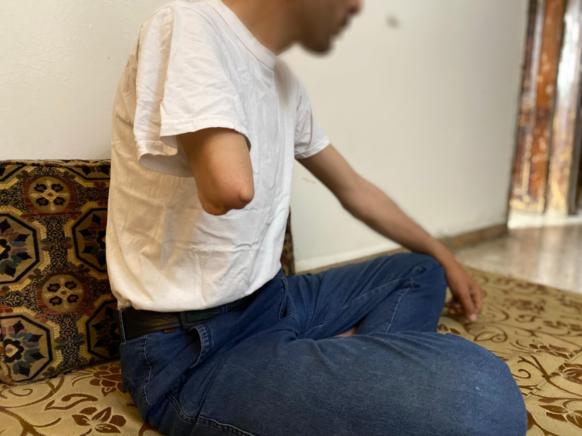 Muhammad had his right arm amputated