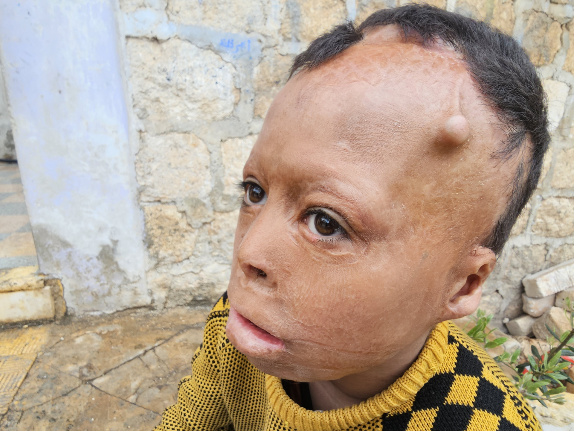 Urgent Humanitarian Cases