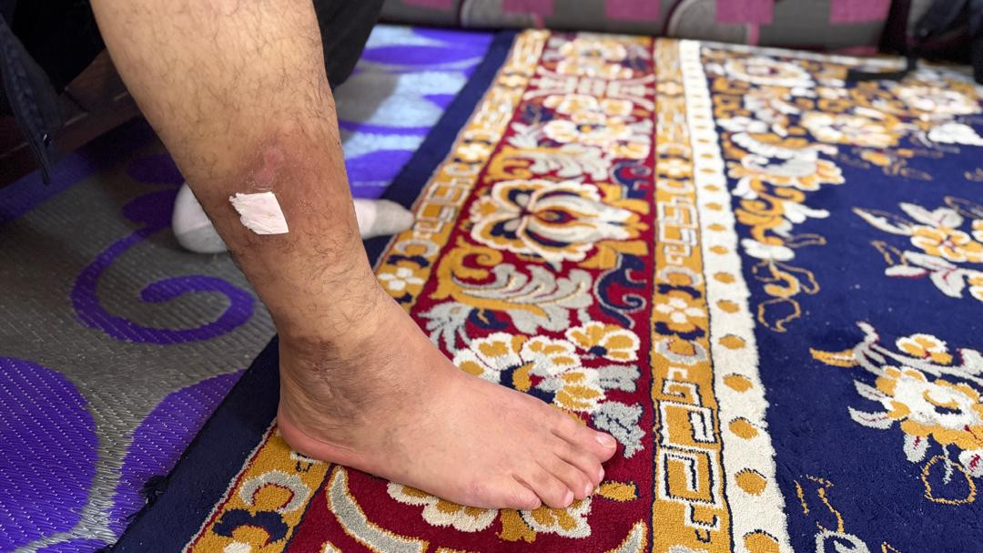 محمود… جسدٌ مثقل بالإصابات